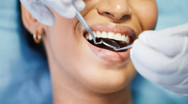 Best Chipped Tooth Repair Near Me  in Lomira, WI